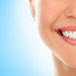 estetica dental